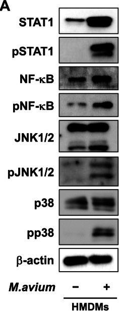 Fig.3.A showing Western Blotting in a Mycobacterium sample from the publication: Mycobacterium avium infection induced PD-L1 overexpression in macrophages: a potential involvement with immune escape.