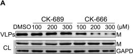 Fig.6.A showing Western Blotting from the publication: Nipah virus matrix protein uses cortical actin to stabilize the virus assembly sites and promote budding.