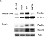 Fig.2.B showing Western Blotting from the publication: The ATP-dependent RNA helicase, DDX42 interacts with paxillin and regulates apoptosis and polarization of Ba/F3 cells.