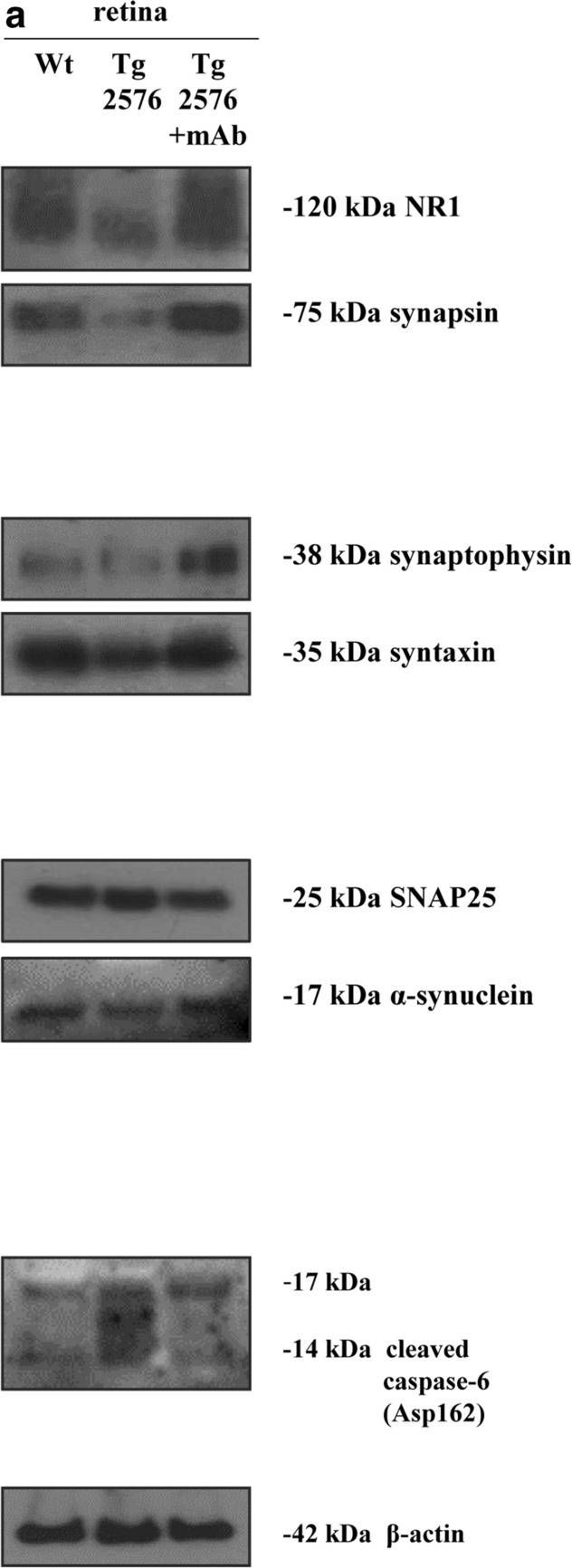 Fig.4.A showing Western Blotting in a Mus musculus (House mouse) sample from the publication: Systemic delivery of a specific antibody targeting the pathological N-terminal truncated tau peptide reduces retinal degeneration in a mouse model of Alzheimer's Disease.
