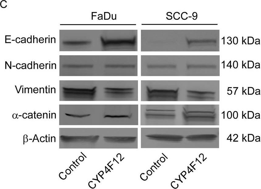 Fig.9.C showing Western Blotting from the publication: CYP4F12 is a potential biomarker and inhibits cell migration of head and neck squamous cell carcinoma via EMT pathway.
