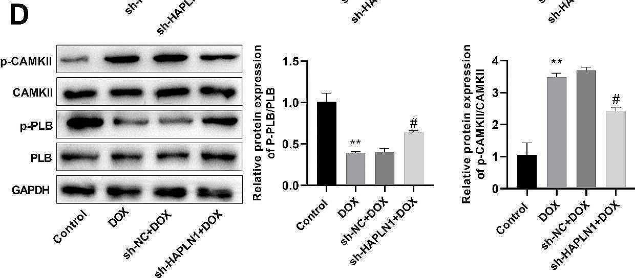 Fig.6.D showing Western Blotting in a Homo sapiens (Human) sample from the publication: HAPLN1 knockdown inhibits heart failure development via activating the PKA signaling pathway.