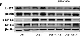Fig.7.F showing Western Blotting from the publication: H7F ameliorates DSS-induced colitis through restoration of intestinal barrier function and inhibition of IL-17/NF-κb signaling.