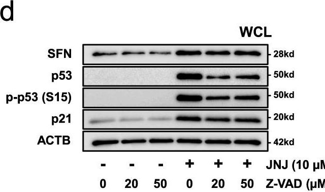 Fig.7.D showing Western Blotting from the publication: Stratifin as a novel diagnostic biomarker in serum for diffuse alveolar damage.