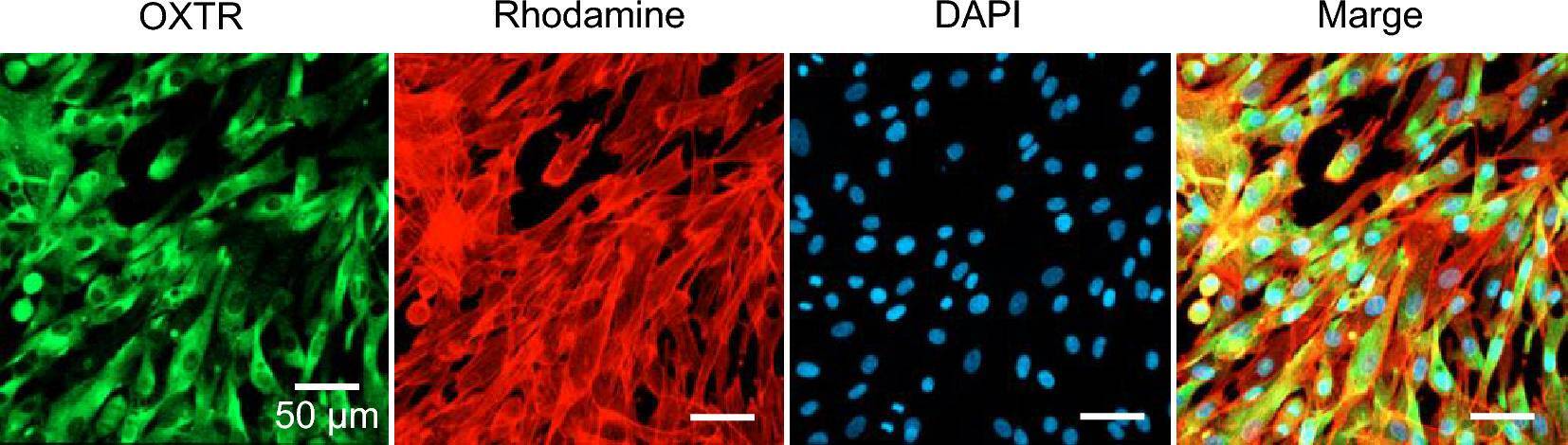 Fig.2.A showing Immunofluorescence in a Homo sapiens (Human) sample from the publication: Effects of oxytocin on the hair growth ability of dermal papilla cells.
