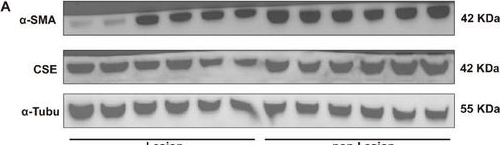 Fig.1.A showing Western Blotting from the publication: NFS1 Regulates IDH2 to Attenuate Abdominal Aortic Aneurysms via Interacting With SP2.