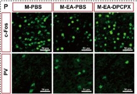 Fig.7.P showing Immunocytochemistry-immunofluorescence in a Mus musculus (House mouse) sample from the publication: Astrocyte inhibition and PV interneuron activation: key mechanisms in electroacupuncture's effect on pain-anxiety comorbidity.