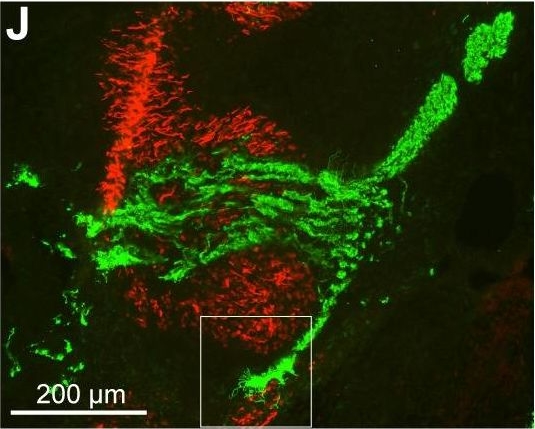 Fig.1.J showing Immunohistochemistry in a Rattus norvegicus (Rat) sample from the publication: First Neuromuscular Contact Correlates with Onset of Primary Myogenesis in Rat and Mouse Limb Muscles.