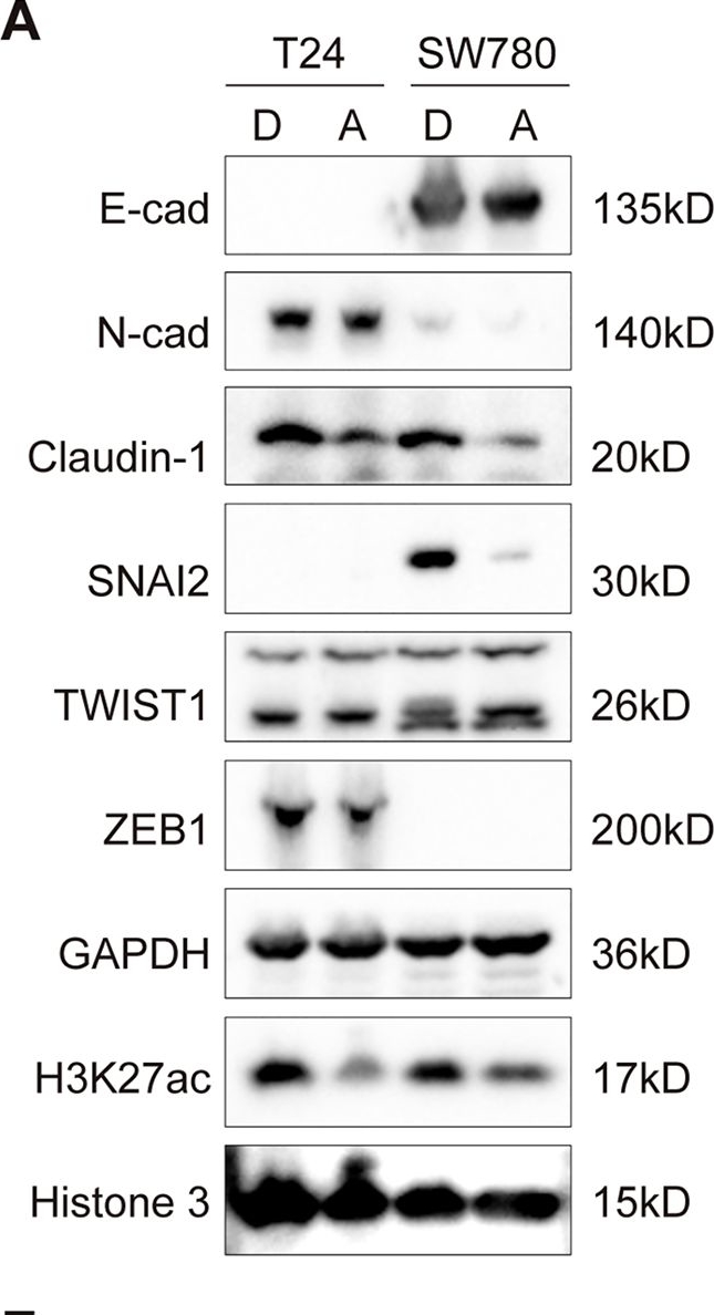 Fig.7.A showing Western Blotting in a Homo sapiens (Human) sample from the publication: EP300 promotes bladder cancer cell migration through SNAI2.