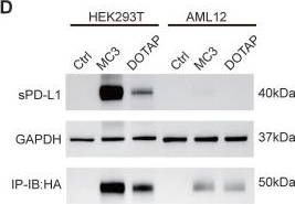 Fig.1.D from the publication: Application of Lung-Targeted Lipid Nanoparticle-delivered mRNA of soluble PD-L1 via SORT Technology in Acute Respiratory Distress Syndrome.