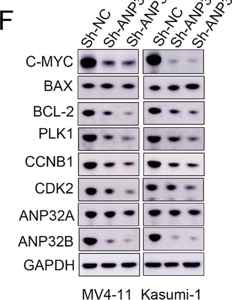 Fig.6.F showing Western Blotting in a Homo sapiens (Human) sample from the publication: Super enhancer related gene ANP32B promotes the proliferation of acute myeloid leukemia by enhancing MYC through histone acetylation.