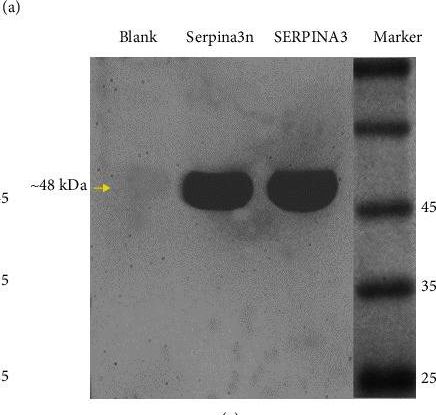 Fig.1.A showing Western Blotting in a Homo sapiens (Human) sample from the publication: Therapeutical Significance of Serpina3n Subsequent Cerebral Ischemia via Cytotoxic Granzyme B Inactivation.