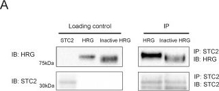 Fig.1.A showing Western Blotting in a Homo sapiens (Human) sample from the publication: Quartz Crystal Microbalance Measurement of Histidine-Rich Glycoprotein and Stanniocalcin-2 Binding to Each Other and to Inflammatory Cells.