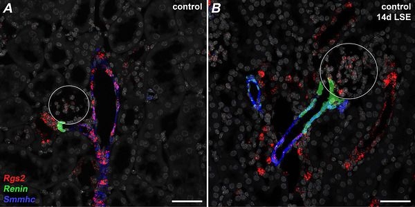 Fig.16.A showing Immunohistochemistry-immunofluorescence in a Mus musculus (House mouse) sample from the publication: The endocrine product of renal (preglomerular) contractile pericytes depends on prolyl-4-hydroxylases 2 and 3.