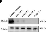 Fig.5.F showing Western Blotting from the publication: DNAH3 deficiency causes flagellar inner dynein arm loss and male infertility in humans and mice.