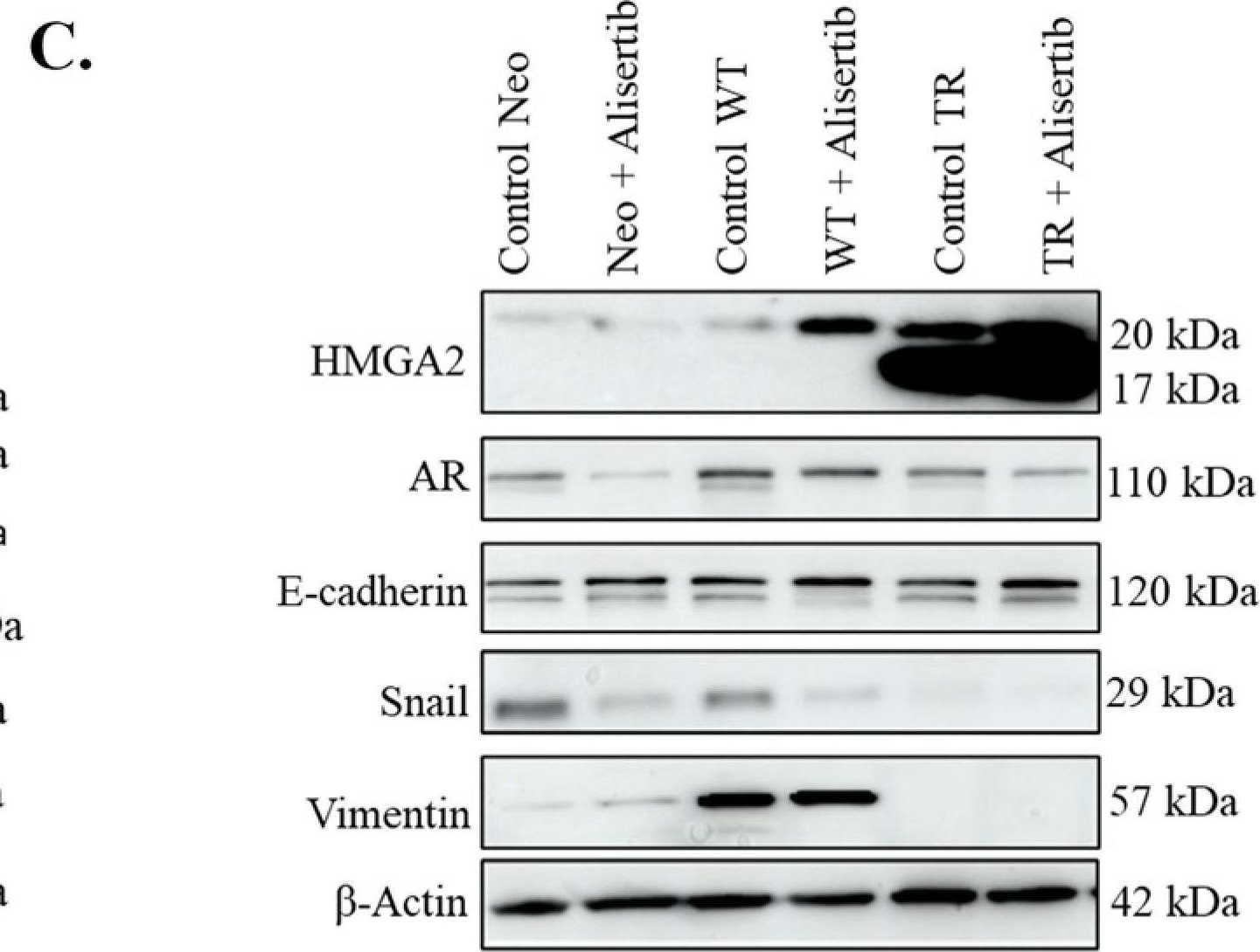 Fig.2.C showing Western Blotting from the publication: High Mobility Group AT-hook 2: A Biomarker Associated with Resistance to Enzalutamide in Prostate Cancer Cells.