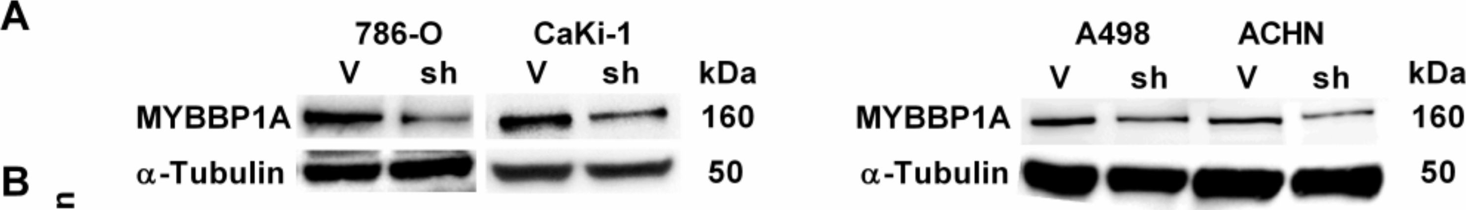 Fig.2.A showing Western Blotting in a Homo sapiens (Human) sample from the publication: Loss of MYBBP1A Induces Cancer Stem Cell Activity in Renal Cancer.