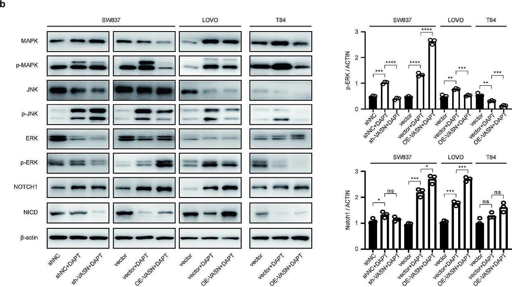 Fig.5.B showing Western Blotting from the publication: Vasorin (VASN) overexpression promotes pulmonary metastasis and resistance to adjuvant chemotherapy in patients with locally advanced rectal cancer.