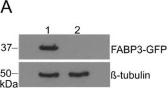 Fig.6.A showing Western Blotting from the publication: Tumor-Targeting Peptides: The Functional Screen of Glioblastoma Homing Peptides to the Target Protein FABP3 (MDGI).