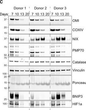 Fig.6.C showing Western Blotting in a Homo sapiens (Human) sample from the publication: BNIP3L/NIX regulates both mitophagy and pexophagy.