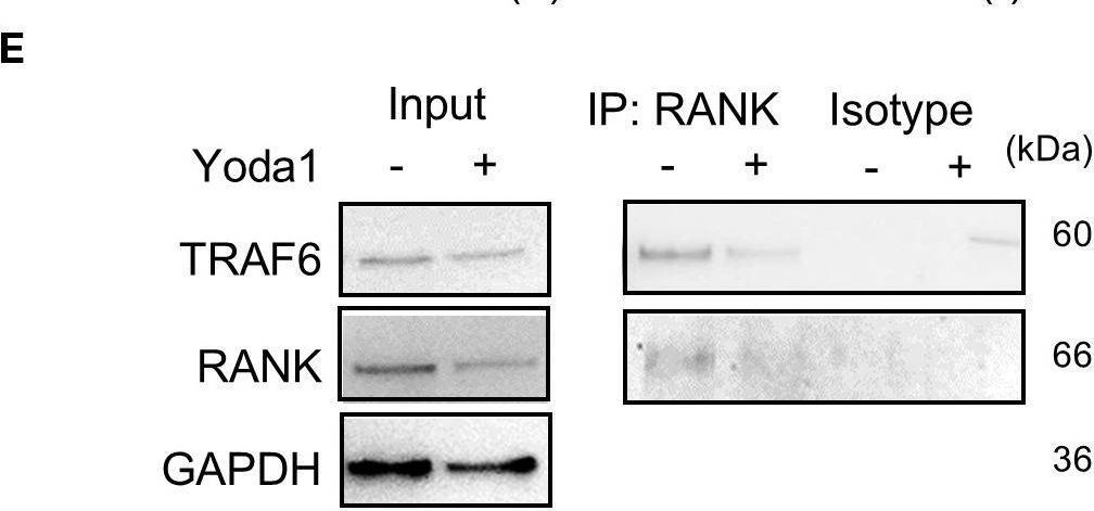 Fig.3.E showing Western Blotting from the publication: Piezo1 protects against inflammatory bone loss via a unique Ca2+-independent mechanism in osteoclasts.