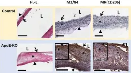 Fig.5.A showing Immunohistochemistry in a Mus musculus (House mouse) sample from the publication: Targeting mannose receptor expression on macrophages in atherosclerotic plaques of apolipoprotein E-knockout mice using 111In-tilmanocept.