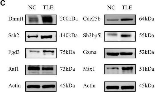 Fig.4.C showing Western Blotting from the publication: Integrated Mendelian Randomization and Single-Cell Transcriptomics Analysis Identifies Critical Blood Biomarkers and Potential Mechanisms in Epilepsy.