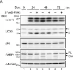 Fig.8.A showing Western Blotting in a Homo sapiens (Human) sample from the publication: Cytoprotective Role of Autophagy in CDIP1 Expression-Induced Apoptosis in MCF-7 Breast Cancer Cells.