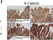 Fig.5.F showing Immunohistochemistry in a Mus musculus (House mouse) sample from the publication: KRAS allelic imbalance drives tumour initiation yet suppresses metastasis in colorectal cancer in vivo.