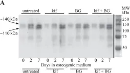 Fig.5.A showing Western Blotting in a Homo sapiens (Human) sample from the publication: Glycans modify mesenchymal stem cell differentiation to impact on the function of resulting osteoblasts.