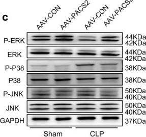 Fig.6.C showing Western Blotting in a Mus musculus (House mouse) sample from the publication: PACS2 Alleviates Sepsis-Induced Myopathy by Activating ERK-MAPK Signalling Pathway to Suppress ER-Phagy.
