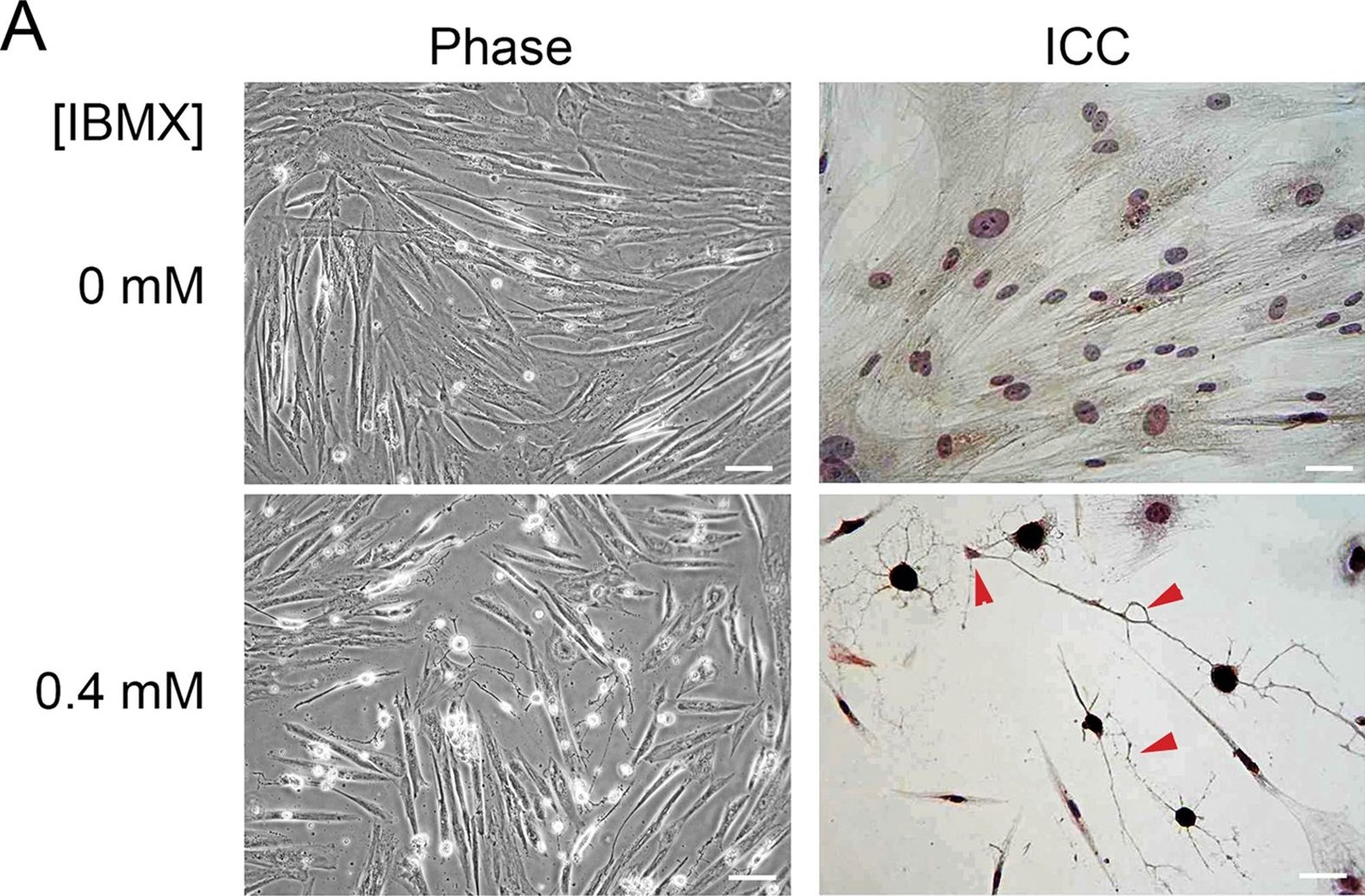 Fig.1.A showing Immunocytochemistry in a Homo sapiens (Human) sample from the publication: Knocking down of heat-shock protein 27 directs differentiation of functional glutamatergic neurons from placenta-derived multipotent cells.