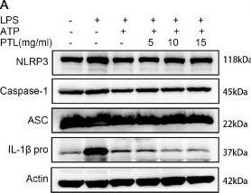 Fig.3.A showing Western Blotting from the publication: Parthenolide attenuated the endometriosis-like lesions by activating autophagy and suppressing NLRP3 inflammasome activity.