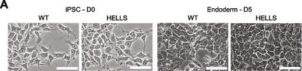 Fig.2.A showing Immunohistochemistry from the publication: HELLS is required for maintaining proper DNA modification at human satellite repeats.