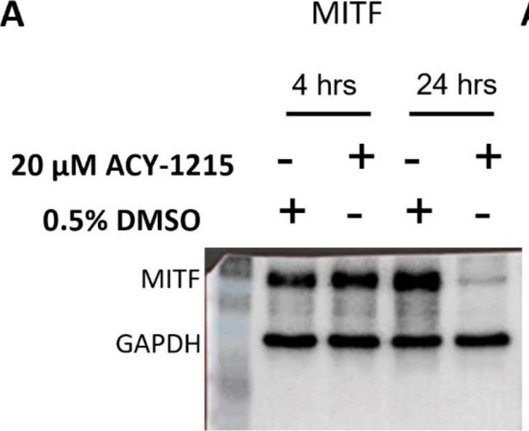 Fig.6.A showing Western Blotting in a Homo sapiens (Human) sample from the publication: Uveal Melanoma Cell Line Proliferation Is Inhibited by Ricolinostat, a Histone Deacetylase Inhibitor.