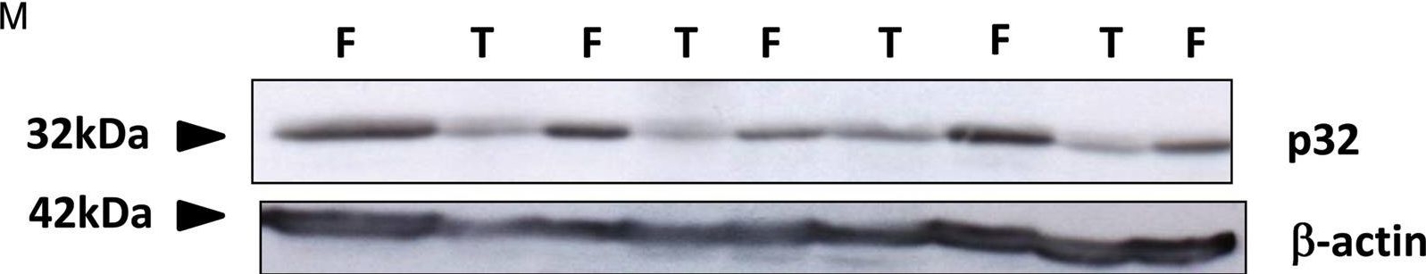 Fig.1.M showing Western Blotting from the publication: A role for the mitochondrial-associated protein p32 in regulation of trophoblast proliferation.