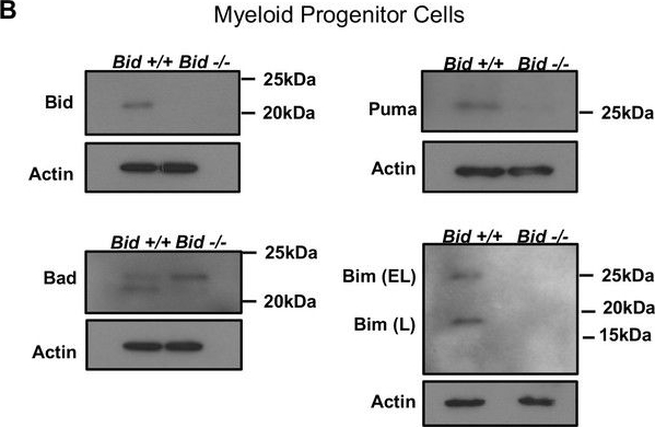 Fig.2.B showing Western Blotting from the publication: Bid maintains mitochondrial cristae structure and function and protects against cardiac disease in an integrative genomics study.