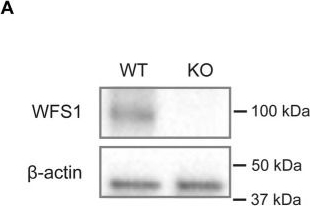 Fig.1.A showing Western Blotting in a Mus musculus (House mouse) sample from the publication: Synaptic alterations are preceding the axonal loss in optic atrophy of Wolfram syndrome mouse model.