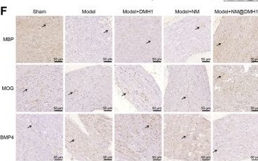 Fig.6.F showing Immunohistochemistry in a Rattus norvegicus (Rat) sample from the publication: DMH1-loaded peptide nanomicelles restore myelin and attenuate neuroinflammation in trigeminal neuralgia via CCL5 suppression.