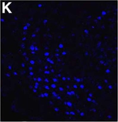 Fig.1.K showing Immunohistochemistry-immunofluorescence in a Mus musculus (House mouse) sample from the publication: Estradiol Preferentially Induces Progestin Receptor-A (PR-A) Over PR-B in Cells Expressing Nuclear Receptor Coactivators in the Female Mouse Hypothalamus