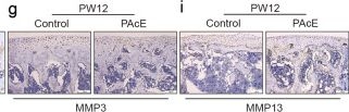 Fig.2.G showing Immunohistochemistry from the publication: HK1-LDHA axis feedback regulation promotes histone lactylation of Wnt5a and mediates prenatal acetaminophen-induced susceptibility to osteoarthritis in male offspring.