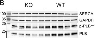 Fig.4.B showing Western Blotting from the publication: Obscurin deficiency leads to compensated dilated cardiomyopathy and increased arrhythmias.