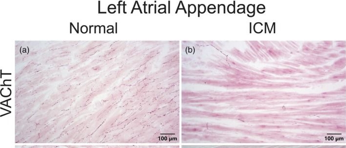 Fig.5.A showing Immunohistochemistry from the publication: Noradrenergic and cholinergic innervation of the normal human heart and changes associated with cardiomyopathy.