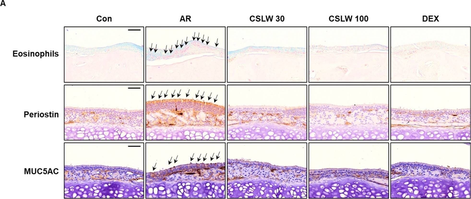 Fig.5.A showing Immunohistochemistry in a Mus musculus (House mouse) sample from the publication: Caesalpinia sappan Linn. Ameliorates Allergic Nasal Inflammation by Upregulating the Keap1/Nrf2/HO-1 Pathway in an Allergic Rhinitis Mouse Model and Nasal Epithelial Cells.
