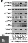 Fig.5.D showing Western Blotting in a Homo sapiens (Human) sample from the publication: TM4SF5 promotes metastatic behavior of cells in 3D extracellular matrix gels by reducing dependency on environmental cues.
