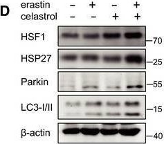 Fig.9.D showing Western Blotting from the publication: Ferroptosis inducer erastin sensitizes NSCLC cells to celastrol through activation of the ROS-mitochondrial fission-mitophagy axis.