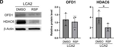 Fig.5.D showing Western Blotting from the publication: Reserpine maintains photoreceptor survival in retinal ciliopathy by resolving proteostasis imbalance and ciliogenesis defects.