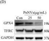 Fig.3.D showing Western Blotting in a Mus musculus (House mouse) sample from the publication: Natural panax notoginseng-derived nanovesicles trigger multiple cell death mechanisms and reprogram chemokine signaling to impede oral squamous cell carcinoma progression.