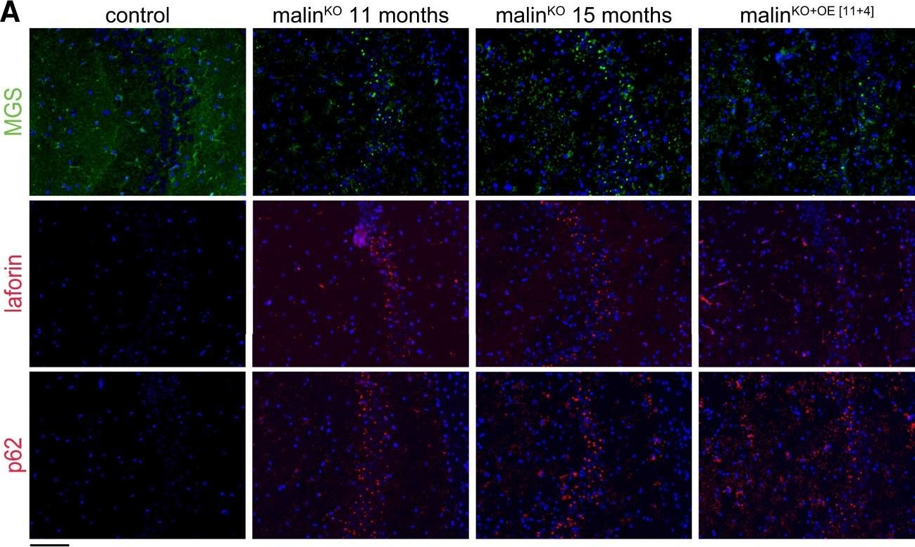 Malin restoration as proof of concept for gene therapy for Lafora disease.