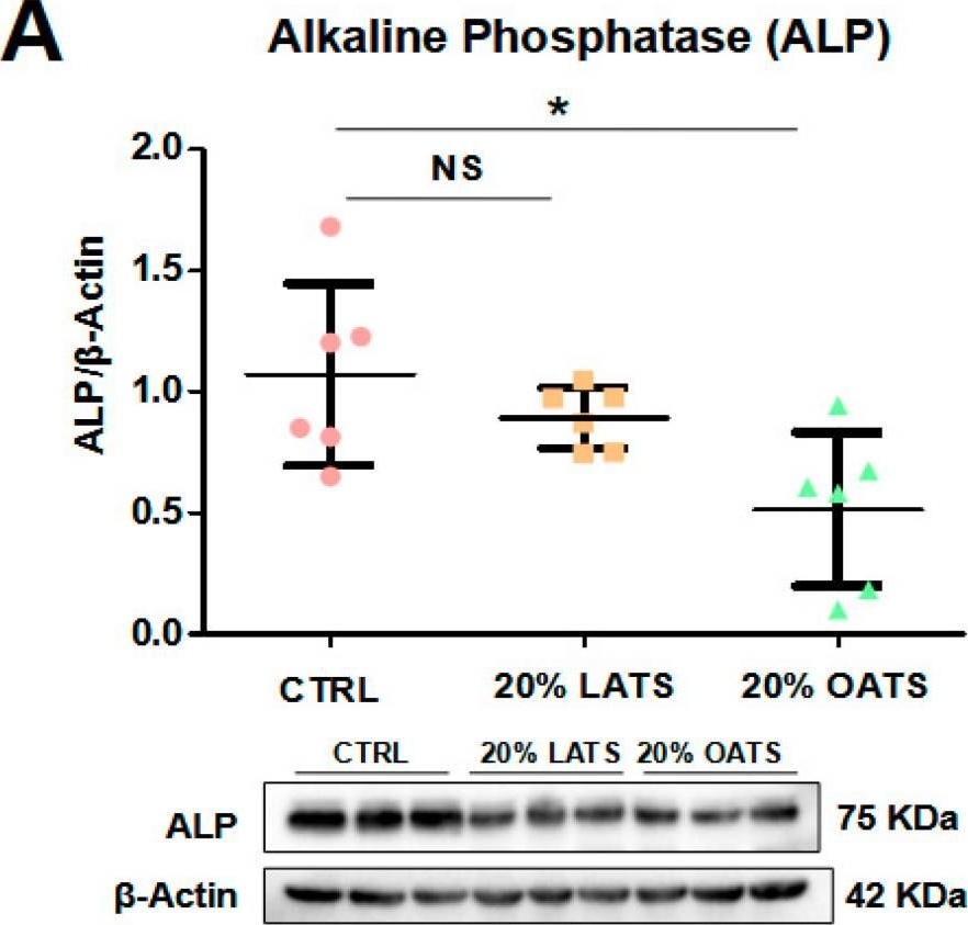 Fig.2.A showing Western Blotting in a Homo sapiens (Human) sample from the publication: Unlocking the Secrets of Adipose Tissue: How an Obesity-Associated Secretome Promotes Osteoblast Dedifferentiation via TGF-β1 Signaling, Paving the Path to an Adipogenic Phenotype.
